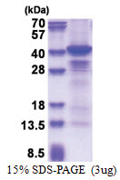 CSNK1A1 (1-337, His-tag) Human Protein