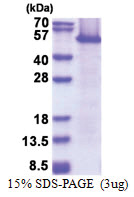 EEF1A1 / LENG7 (1-462) Human Protein
