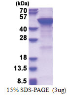 MGAT2 (30-447, His-tag) Human Protein
