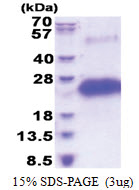 CD40 (21-193, His-tag) Human Protein