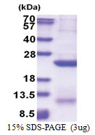 Glypican-4 (GPC4) (401-529, His-tag) Human Protein