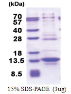 IRF5 (176-240, His-tag) Human Protein