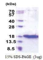 ZG16 (17-167, His-tag) Human Protein