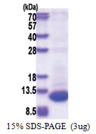 DPH3P1 (1-78, His-tag) Human Protein