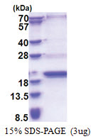 C20orf79 (1-156, His-tag) Human Protein