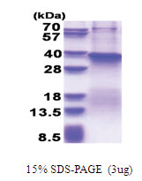 Fucosyltransferase 7 (37-342, His-tag) Human Protein