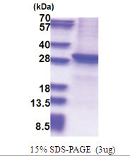 SIRT1 (254-495, His-tag) Human Protein