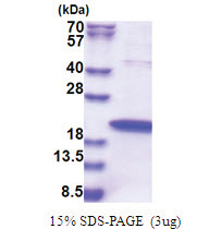 ZNHIT1 (1-154, His-tag) Human Protein
