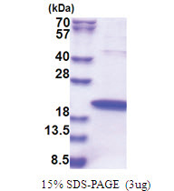 ZNHIT1 (1-154, His-tag) Human Protein