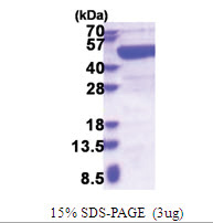 PAICS / ADE2 (1-425, His-tag) Human Protein