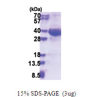 EXOSC8 (1-276, His-tag) Human Protein