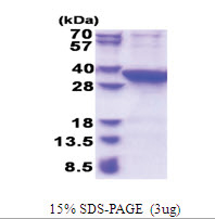 PROSC (1-275, His-tag) Human Protein