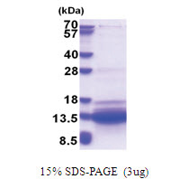 SVIP (1-77, His-tag) Human Protein
