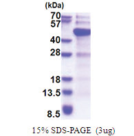 DNMT3L (1-387, His-tag) Human Protein