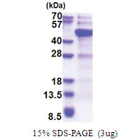 DNMT3L (1-387, His-tag) Human Protein
