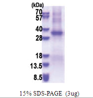 TSSK6 / SSTK (1-273, His-tag) Human Protein