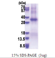 TSSK6 / SSTK (1-273, His-tag) Human Protein