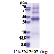 Adenosine deaminase-like protein (ADAL) (1-267, His-tag) Human Protein