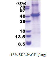 CD5 (25-372, His-tag) Human Protein
