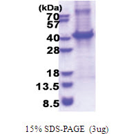 CD5 (25-372, His-tag) Human Protein