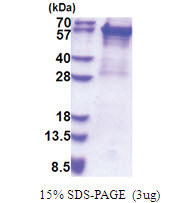 Cytokeratin 5 (1-590, His-tag) Human Protein