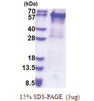 Cytokeratin 5 (1-590, His-tag) Human Protein