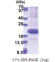 Adiponectin (108-244, His-tag) Human Protein
