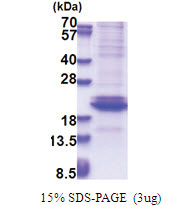 Adiponectin (108-244, His-tag) Human Protein