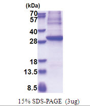 GAD1 / GAD67 (1-224, His-tag) Human Protein