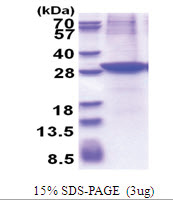 ACAM / ASAM (19-235, T7-tag) Human Protein