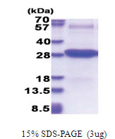 CD102 / ICAM2 (22-223, His-tag) Human Protein