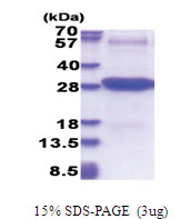 CD102 / ICAM2 (22-223, His-tag) Human Protein