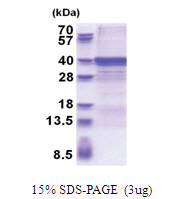 ZW10 interactor / ZWINT (1-230, His-tag) Human Protein