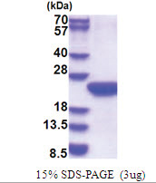 POLR2F (1-127, His-tag) Human Protein