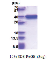 RPRD1A (1-312, His-tag) Human Protein