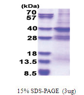 MED27 (1-311, His-tag) Human Protein