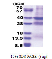 MED27 (1-311, His-tag) Human Protein