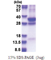 COPS7A (1-275, His-tag) Human Protein