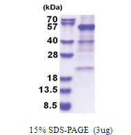 Glutamate dehydrogenase 1 (54-558, His-tag) Human Protein