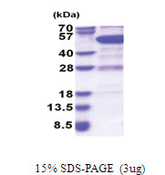 Rab GDI beta / GDI2 (1-445, His-tag) Human Protein