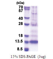 PF4V1 (31-104, His-tag) Human Protein