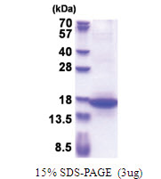 MFAP3 (19-147, His-tag) Human Protein