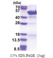 Cytohesin 3 (1-399, His-tag) Human Protein