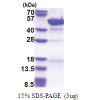 Cytohesin 3 (1-399, His-tag) Human Protein