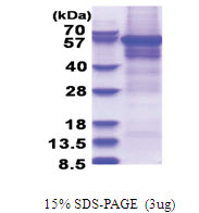 CPEB1 (1-561, His-tag) Human Protein