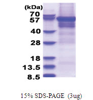 CPEB1 (1-561, His-tag) Human Protein