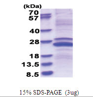 MMP-23 (79-254, His-tag) Human Protein