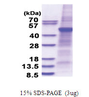 PLA1A (26-456, His-tag) Human Protein