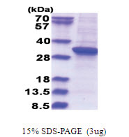 RSU1 / RSP1 (1-277, His-tag) Human Protein