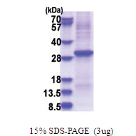 KLK10 / Kallikrein-10 (34-276, His-tag) Human Protein